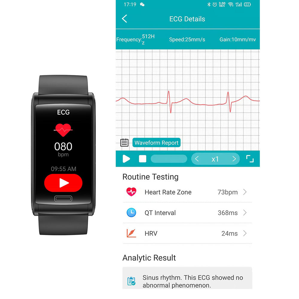 HENTIK BCE600 Smart Bracelet – Wellness Tracker with Heart Rate, SpO₂, Sleep Monitoring & Fitness Modes